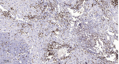 MMP26 (Cleaved-Thr90) rabbit pAb
