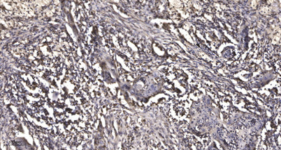 MMP28 (Cleaved-Phe123) rabbit pAb