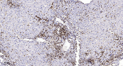 MMP7 (Cleaved-Tyr95) rabbit pAb