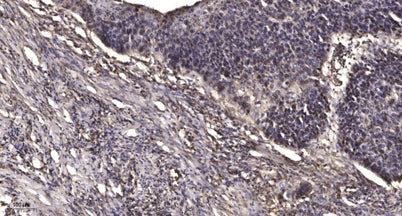 MMP8 (Cleaved-Leu101) rabbit pAb