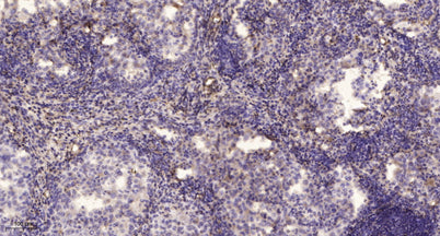 MMP9 (Cleaved-Phe107) rabbit pAb