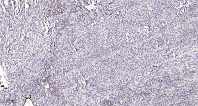 PERM (light chain, Cleaved-Gly278) rabbit pAb