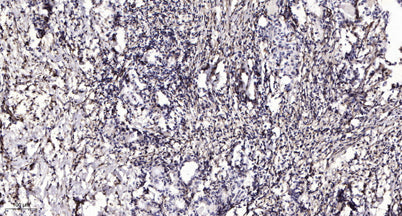 Plasma Kallikrein LC (Cleaved-I391) rabbit pAb