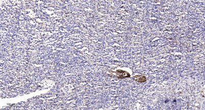 Karyopherin α2 (Acetyl Lys22) rabbit pAb