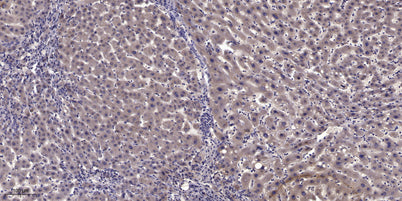 MyoD (Acetyl Lys99/K102) rabbit pAb