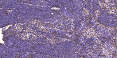 MYH-pan (Acetyl Lys1394) rabbit pAb