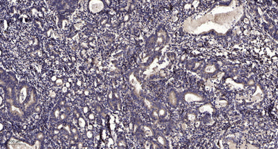Smad2/3 (Acetyl Lys420/378) rabbit pAb