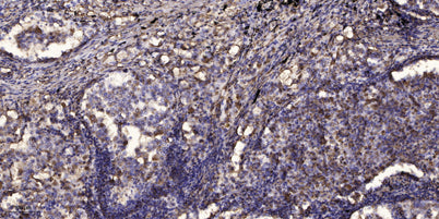 Smad7 (Acetyl Lys70) rabbit pAb