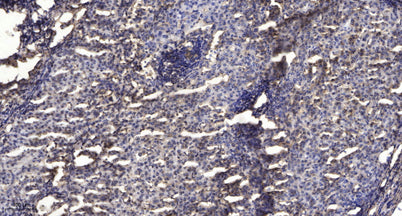 Stat1 (Acetyl Lys410/K413) rabbit pAb