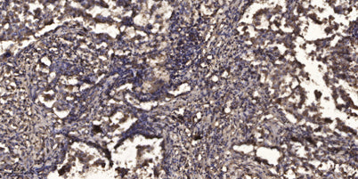 Stat2 (Acetyl Lys384) rabbit pAb