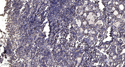 Stat5a (Acetyl Lys84) rabbit pAb