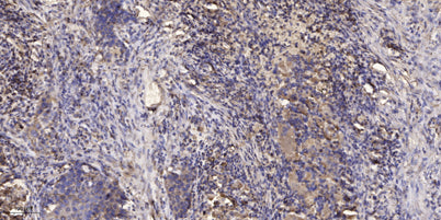 IR (Phospho Tyr999) rabbit pAb