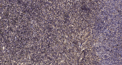 NFAT1 (Phospho Ser326) rabbit pAb