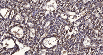 PPAR α (Phospho Ser21) rabbit pAb