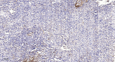 Smad1 (Phospho Ser214) rabbit pAb