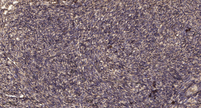 Smad2 (Phospho Ser255) rabbit pAb