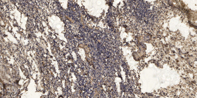 Rb (Phospho Thr252) rabbit pAb