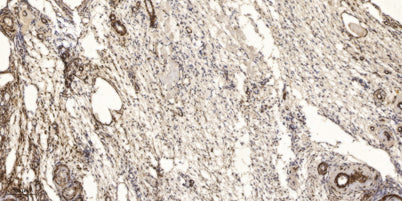 Phospho PKC θ (Y90) rabbit pAb