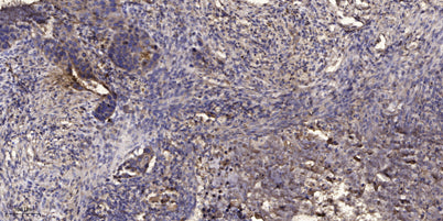 IP3 Receptor (Phospho Tyr353) rabbit pAb