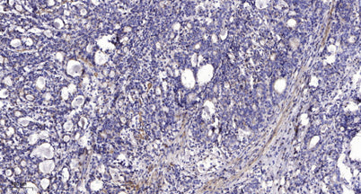 LAT (Phospho Tyr255) rabbit pAb