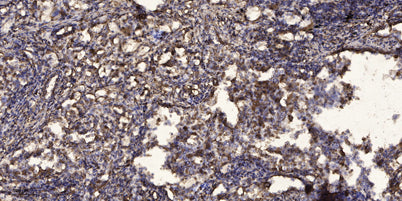 PDK1 (Phospho Tyr243) rabbit pAb