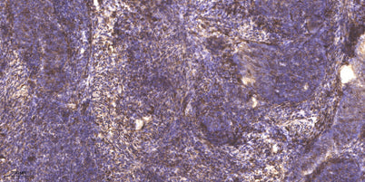 PCSK9 rabbit pAb