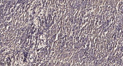 Mesothelin rabbit pAb