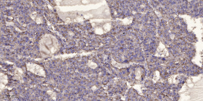 LC3 A/B rabbit pAb