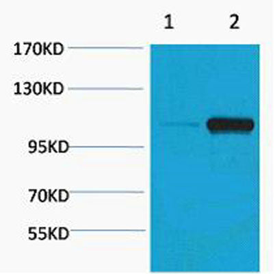 PEPC (Phospho Ser15) rabbit pAb