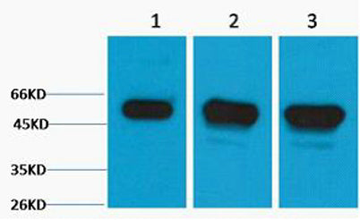 β III Tubulin rabbit pAb