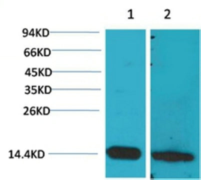 S100 β rabbit pAb