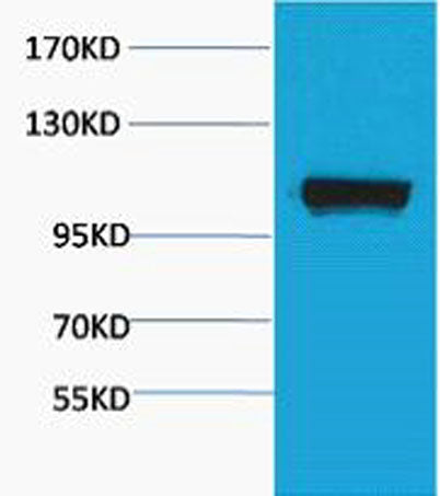 PEPC rabbit pAb