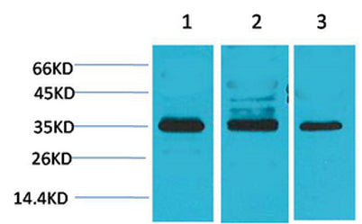 L-type Ca++ CP γ4 rabbit pAb