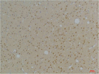 KVβ1 rabbit pAb