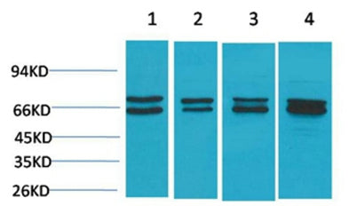Estrogen Receptor α rabbit pAb