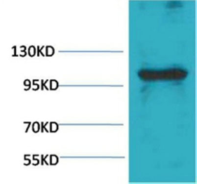 eEF1A2 binding protein rabbit pAb