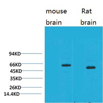 EAAT2 rabbit pAb