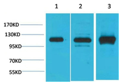 CaVα2δ2 rabbit pAb
