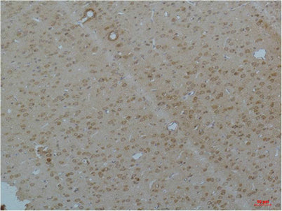 Cav pan α1 rabbit pAb