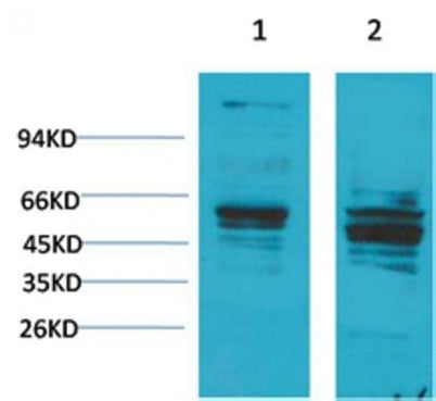 Bombesin Receptor 2 rabbit pAb