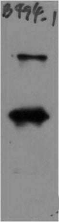 SARS-COV-2 Spike Protein S1 Rabbit pAb