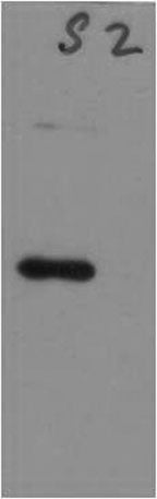 SARS-COV-2 Spike Protein S2 Rabbit pAb