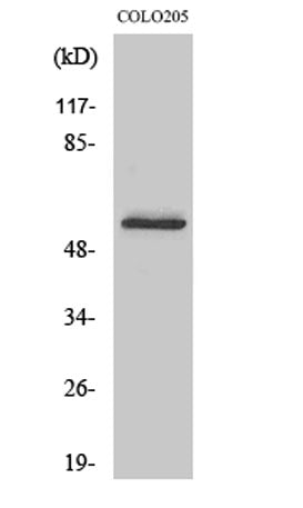 Glucagon Receptor rabbit pAb