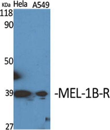 MEL-1B-R rabbit pAb