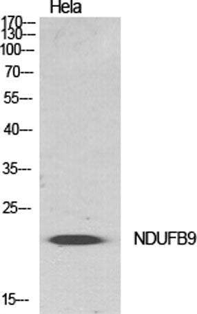 NDUFB9 rabbit pAb