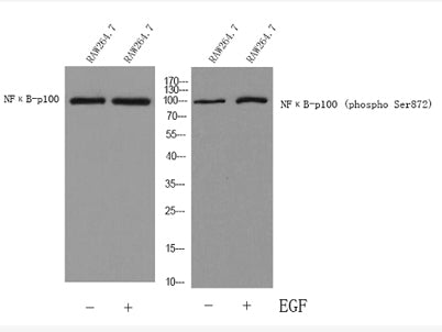 NFκB-p100 rabbit pAb