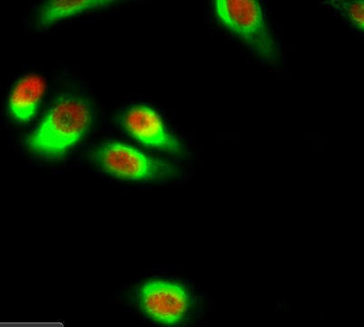 NFκB-p65 rabbit pAb