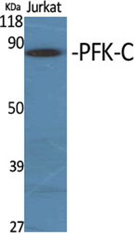 PFK-C rabbit pAb