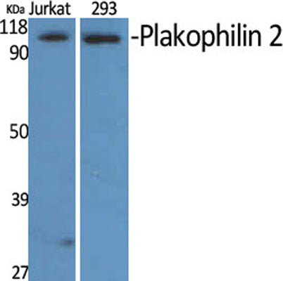 Plakophilin 2 rabbit pAb