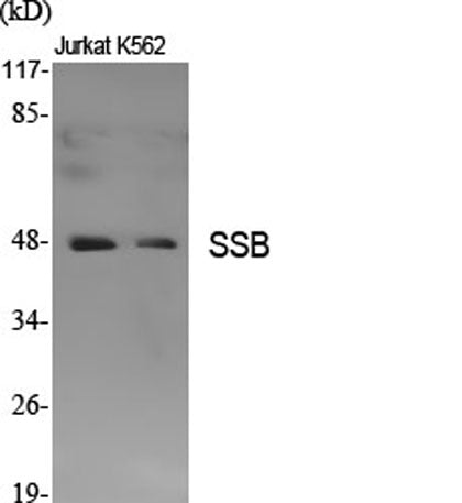 SSB rabbit pAb